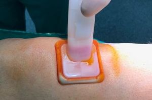 ein Applikator zur Desinfektion wird auf die Haut gedrückt